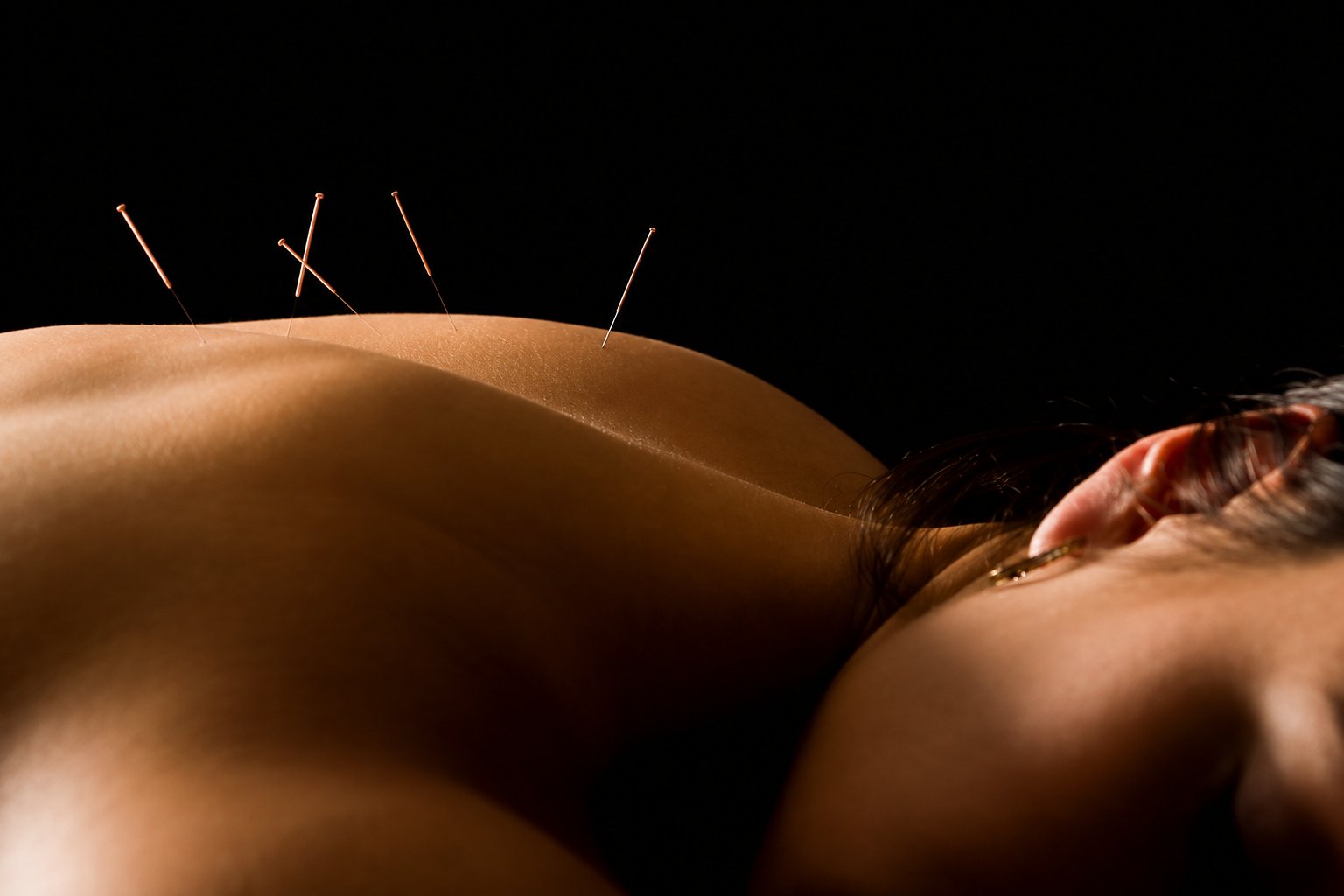 Massage + Acupuncture at Elevate Ritual